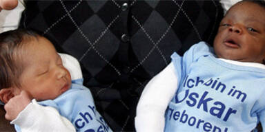 Schwarzes und weißes Zwillingsbaby geboren