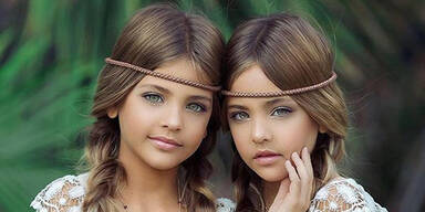Das sind die schönsten Zwillinge der Welt